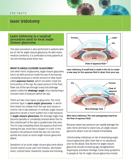 laseriridotomy